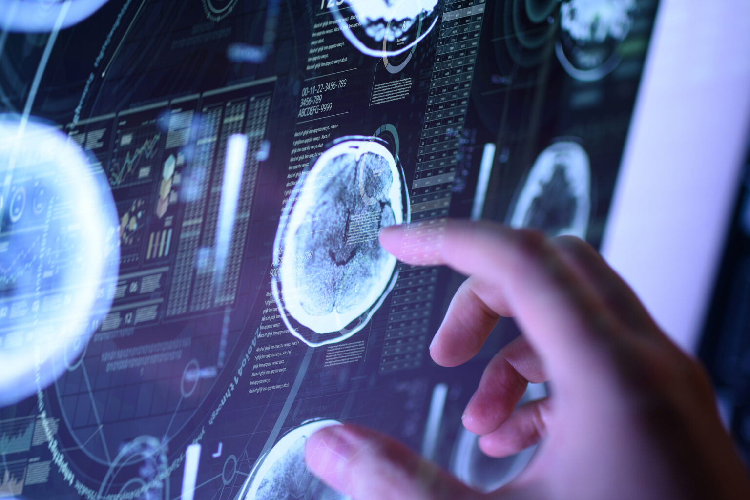 髄膜炎とは?症状・ワクチンについて ワクチンNavi